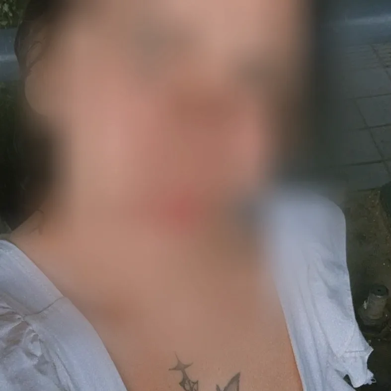 Franziska, 22